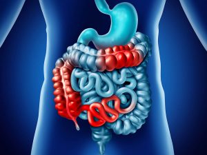 What Is The Prognosis for People With Crohn’s Disease?