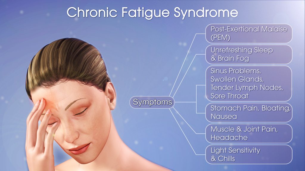 Chronic Fatigue Syndrome: Symptoms and Causes