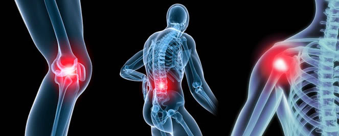 The Pandemic Of Workplace Musculoskeletal Disorders