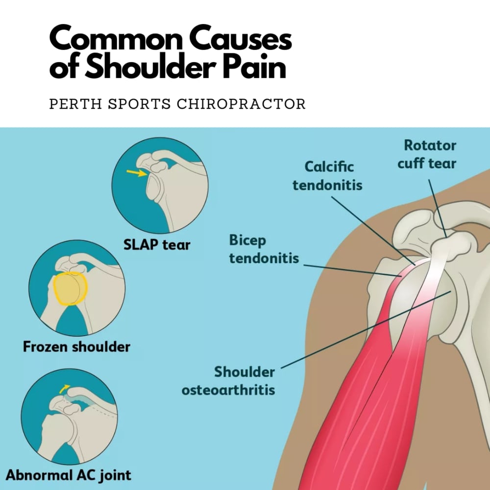 What Causes Shoulder Pain?